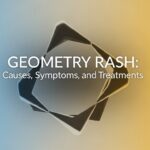 Geometry Rash: Causes, Symptoms, and Treatments
